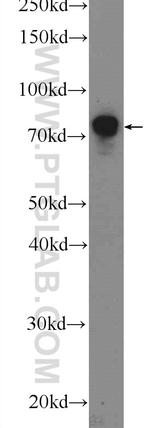 TBX2 Antibody in Western Blot (WB)
