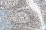 CD79A Antibody in Immunohistochemistry (Paraffin) (IHC (P))