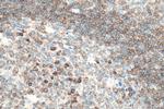 CD79A Antibody in Immunohistochemistry (Paraffin) (IHC (P))
