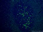 CD79A Antibody in Immunohistochemistry (PFA fixed) (IHC (PFA))