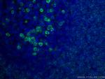 CD79A Antibody in Immunohistochemistry (PFA fixed) (IHC (PFA))