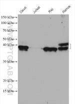 CD79A Antibody in Western Blot (WB)
