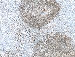 CD79A Antibody in Immunohistochemistry (Paraffin) (IHC (P))