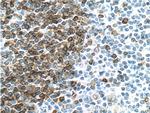 CD79A Antibody in Immunohistochemistry (Paraffin) (IHC (P))