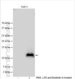 CCL4/MIP-1 beta Antibody in Western Blot (WB)