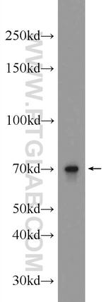 ALX3 Antibody in Western Blot (WB)