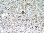 BRCA1 Antibody in Immunohistochemistry (Paraffin) (IHC (P))