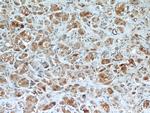 BRCA1 Antibody in Immunohistochemistry (Paraffin) (IHC (P))