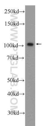 BRCA1 Antibody in Western Blot (WB)