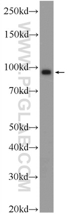 BRCA1 Antibody in Western Blot (WB)