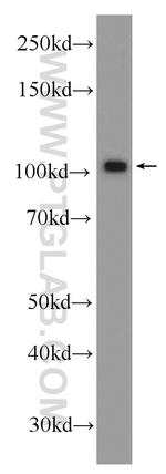 BRCA1 Antibody in Western Blot (WB)