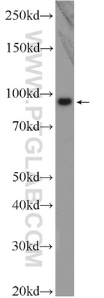 BRCA1 Antibody in Western Blot (WB)