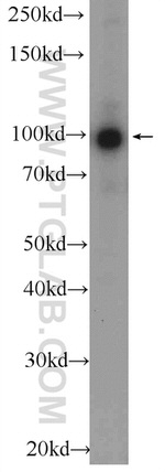 BRCA1 Antibody in Western Blot (WB)