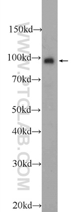 BRCA1 Antibody in Western Blot (WB)