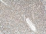 GYS2 Antibody in Immunohistochemistry (Paraffin) (IHC (P))