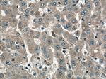 GYS2 Antibody in Immunohistochemistry (Paraffin) (IHC (P))