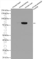 GYS2 Antibody in Western Blot (WB)