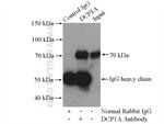DCP1A Antibody in Immunoprecipitation (IP)