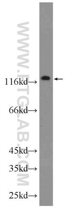 TTI1 Antibody in Western Blot (WB)