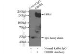 ERBB4 Antibody in Immunoprecipitation (IP)