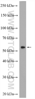 IRF7 Antibody in Western Blot (WB)