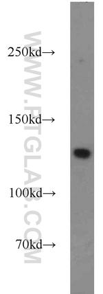 MSH3 Antibody in Western Blot (WB)