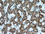 AGXT Antibody in Immunohistochemistry (Paraffin) (IHC (P))
