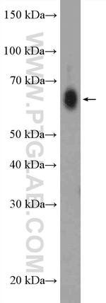 ZCCHC7 Antibody in Western Blot (WB)
