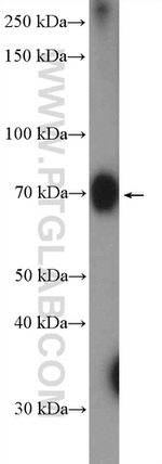 ZCCHC7 Antibody in Western Blot (WB)