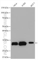 Casein Kinase 2 beta Antibody in Western Blot (WB)