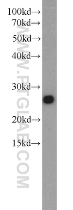 Casein Kinase 2 beta Antibody in Western Blot (WB)