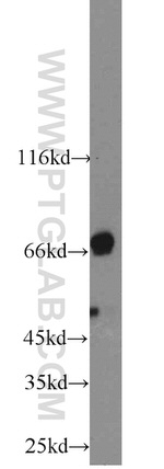 ADRA1B Antibody in Western Blot (WB)