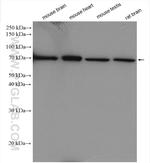 ADRA1B Antibody in Western Blot (WB)