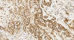 Adiponectin receptor 1 Antibody in Immunohistochemistry (Paraffin) (IHC (P))