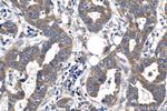 SPDYC Antibody in Immunohistochemistry (Paraffin) (IHC (P))