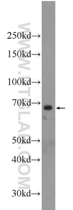 FOXA2 Antibody in Western Blot (WB)