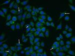 CEP290 Antibody in Immunocytochemistry (ICC/IF)