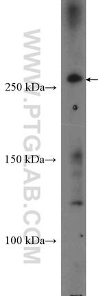 CEP290 Antibody in Western Blot (WB)