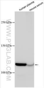 C5 Antibody in Western Blot (WB)
