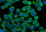 PPP1R3A Antibody in Immunocytochemistry (ICC/IF)
