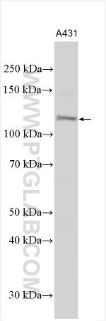 PPP1R3A Antibody in Western Blot (WB)