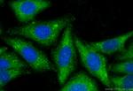 LLGL1 Antibody in Immunocytochemistry (ICC/IF)