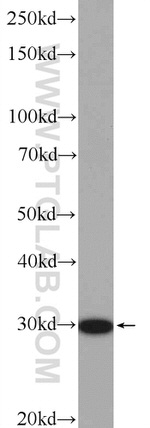 CNOT9 Antibody in Western Blot (WB)