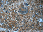 HPGDS Antibody in Immunohistochemistry (Paraffin) (IHC (P))