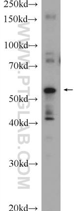 ABHD15 Antibody in Western Blot (WB)
