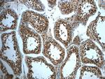 TMEM168 Antibody in Immunohistochemistry (Paraffin) (IHC (P))