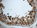 TMEM168 Antibody in Immunohistochemistry (Paraffin) (IHC (P))