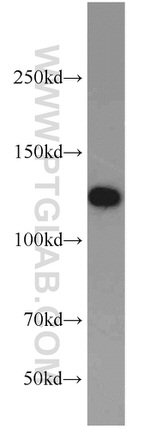 TMEM168 Antibody in Western Blot (WB)