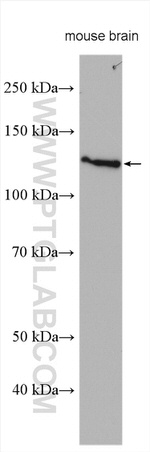 TMEM168 Antibody in Western Blot (WB)