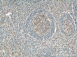 GAB2 Antibody in Immunohistochemistry (Paraffin) (IHC (P))